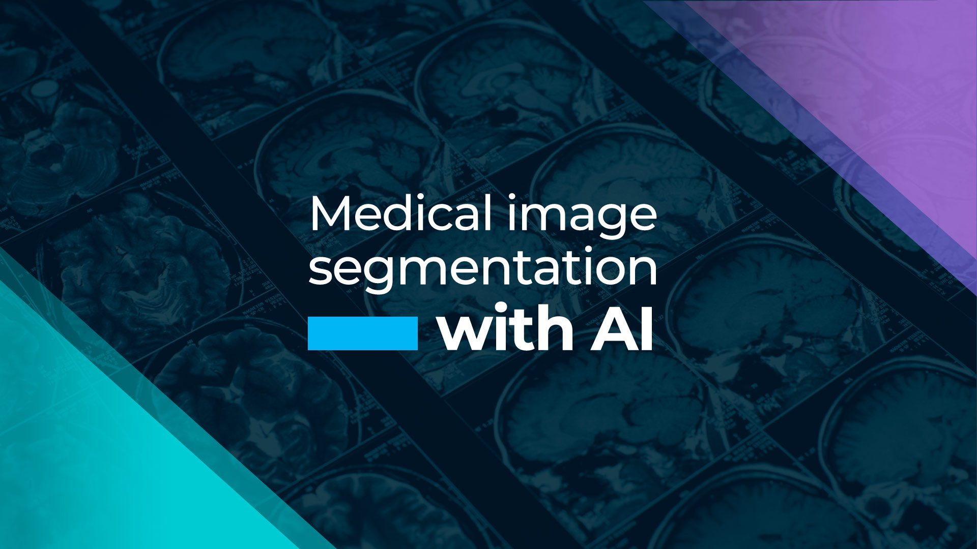 Medical image segmentation with AI